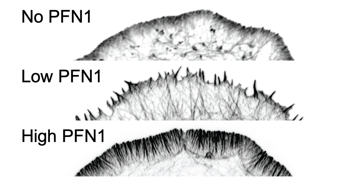 So, we are able to see Mena/VASP and Arp2/3 competition at low PFN1 concentrations. What happens at normal levels? Here, there is enough PFN1-actin for everybody and lamellipodia and linear arrays co-exist at the leading edge. There are no filopodia at all, though. 50/