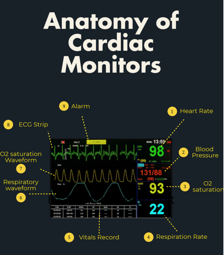 How To Read Heart Monitor Lines