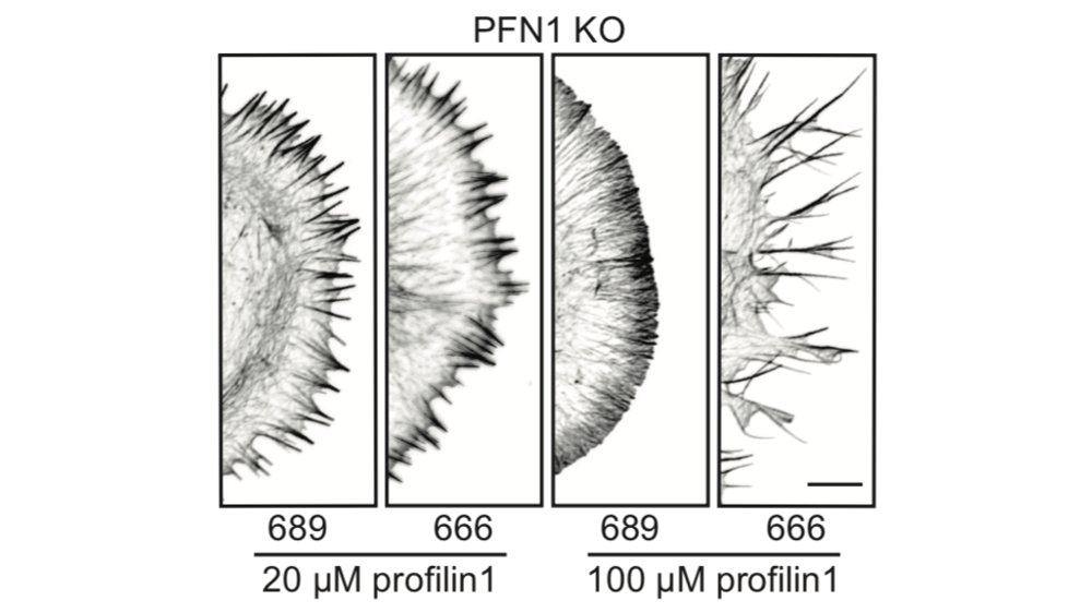 This is probably because Arp2/3 networks inhibit their formation once they get going. Here is what happens when you inhibit Arp2/3 in the presence of a normal dose of PFN1 protein. Filopodia explode from the cell edge. 51/