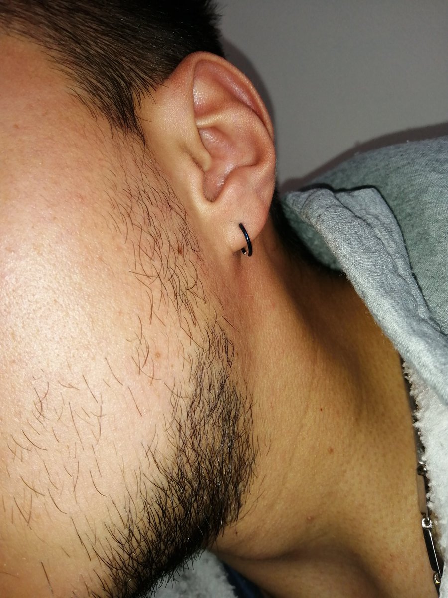Diario_Minox_'s tweet photo. Y así va creciendo poco a poco los vellos en su desarrollo de crecimiento.
Día 23 de tratamiento 🧔🏻 https://t.co/L3WOjP1JGN