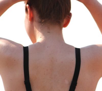 apex_spine's tweet image. Es gibt verschiedene Risiken bei der offenen Operation an der Halswirbelsäule. Diese sind jedoch als gering einzustufen und in der Regel vorübergehender Natur.
Wie kompliziert ist eine HWS-Operation?

buff.ly/2NonI8c