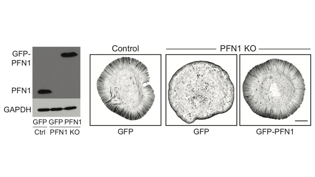 So we make the PFN1 KO CAD cells. They survive! We can also rescue them with physiological levels of GFP-PFN1 as a control. 15/