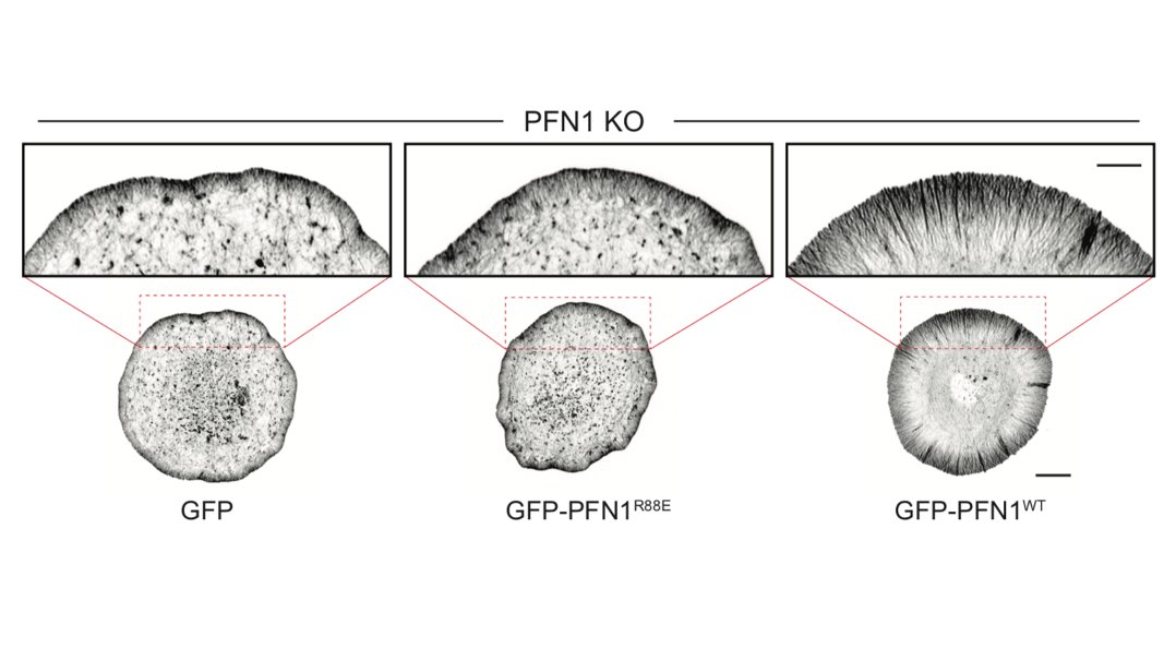 The biggest effects were are the leading edge, though, so we focused our attention there. FYI, the R88E mutant shown below is actin-binding deficient. 18/