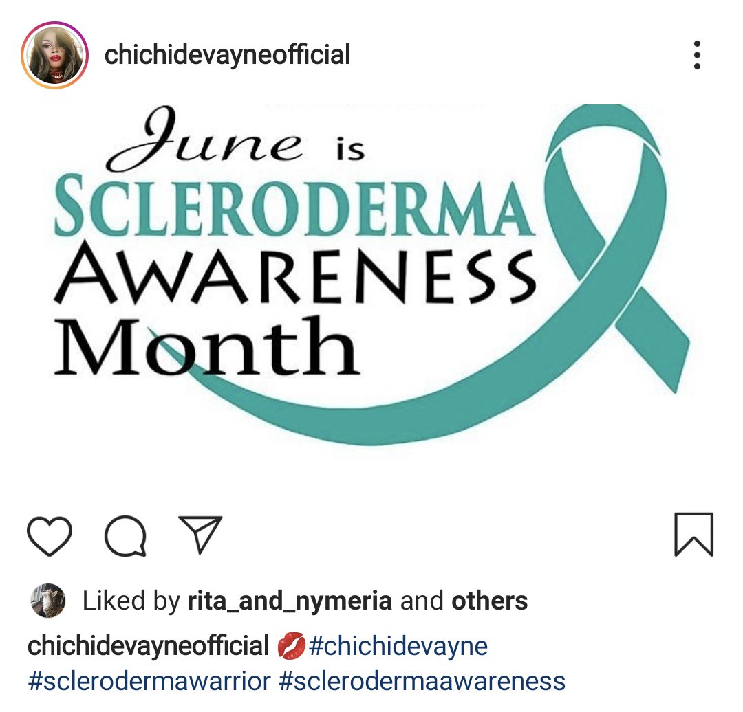 SclerodermaCAN's tweet photo. 👏👏👏 Chi Chi DeVayne of #RuPaulsDragRace season 8, diagnosed with scleroderma, is using her platform to spread awareness of this terrible disease during #SclerodermaAwarenessMonth.
This means a great deal to us. @RuPaulsDragRace https://t.co/xbgxYivzO6