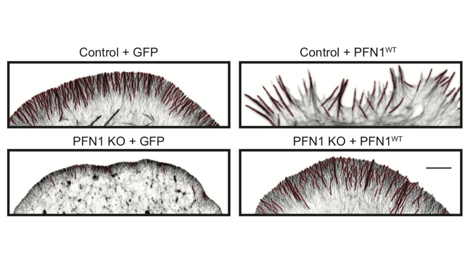 But it's not just the amount of actin at the leading edge that is different, but also the filament architecture. 21/