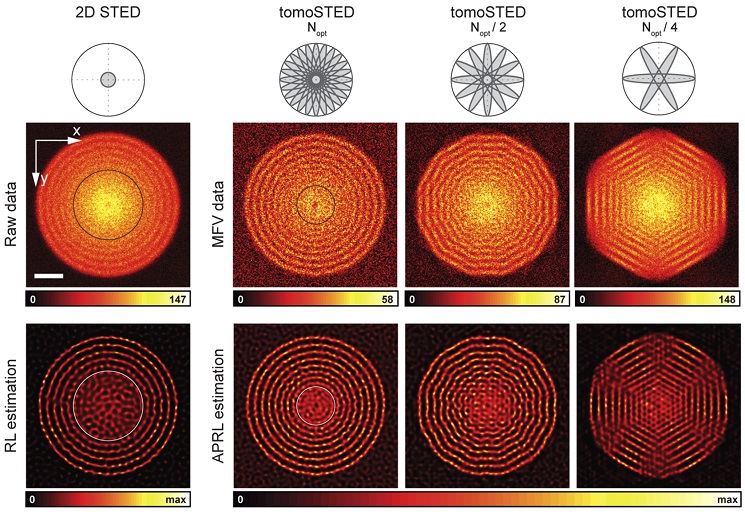 OpticaPubsGroup's tweet photo. An Editors' Pick via #OSA_BOEx: Tomographic STED microscopy https://t.co/q8jmSpvEzC #PointSpreadFunctions #ReconstructionAlgorithms @uniGoettingen https://t.co/ljDly1Bv8M