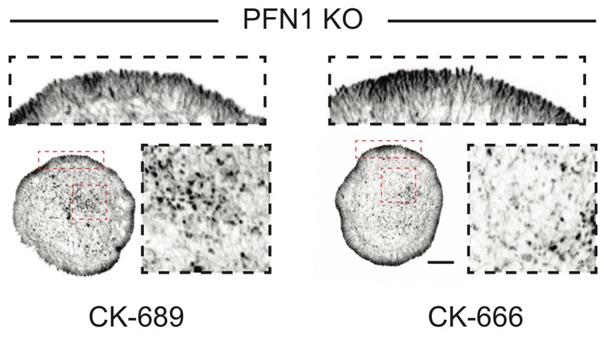 Also, I really want to do EM on CK-666 treated PFN1 KO cells. Where are those actin filaments coming from? Arp2/3 is not at the edge, and the inhibitor should have knocked out any residual activity there. Not Mena/VASP either...59/