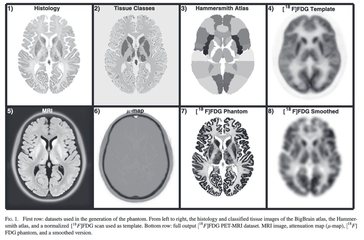An interesting, thoughtful method to create high-resolution heterogeneous digital brain #PET phantoms:
kclpure.kcl.ac.uk/portal/files/1…