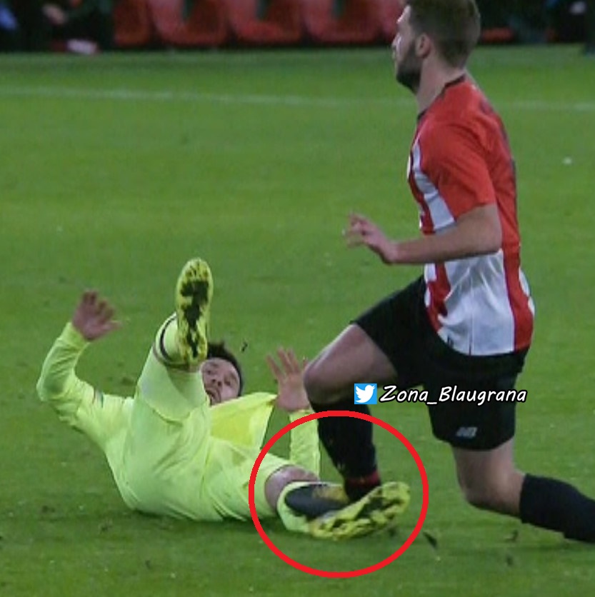 Zona_Blaugrana's tweet photo. La caverna pide la expulsión de Messi por un pisotón a Yeray sin ninguna intención, dicen que si fuese al revés hubieran expulsado al jugador del Athletic. 

La realidad es que el año pasado Yeray pisó a Messi, no lo expulsaron, no intervino el VAR y la caverna ocultó lo sucedido https://t.co/ItXcRD7UqG