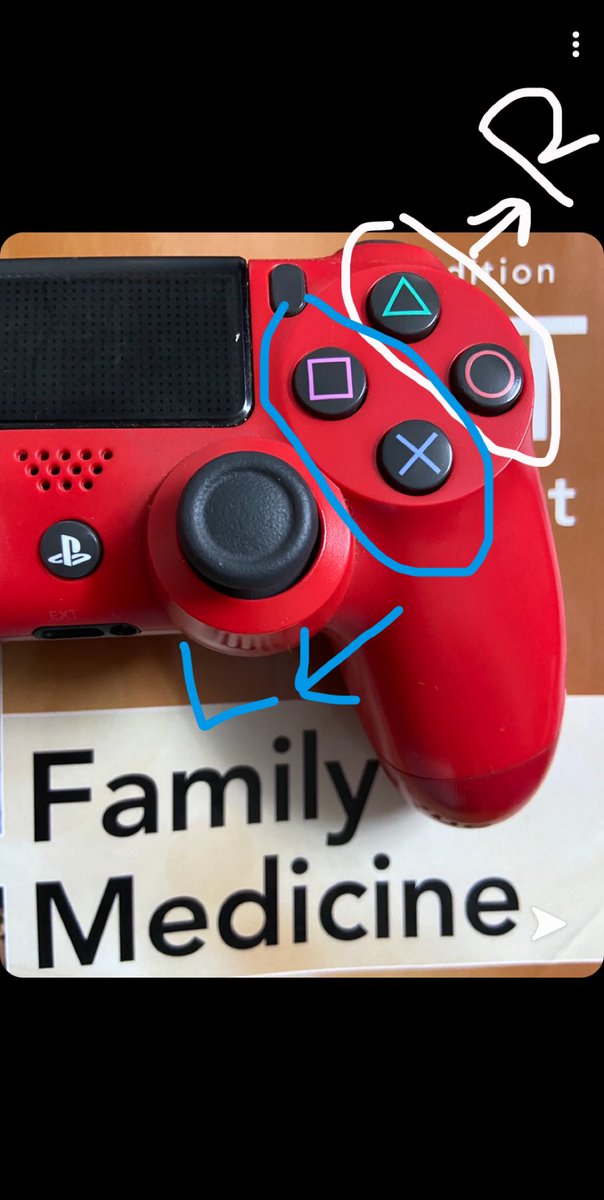 DrAlshumrani's tweet photo. To remember symbols on the “#Audiograms” quickly .. 
Try to imagine this “game controller” symbols “🔴🔺" which is represent right ear is already on the right side and vice versa.. it’s tha same with left ear “🟦✖️”
all of these for “AC”

#made_easy ✌🏻🤠 https://t.co/hOlNFrmlng