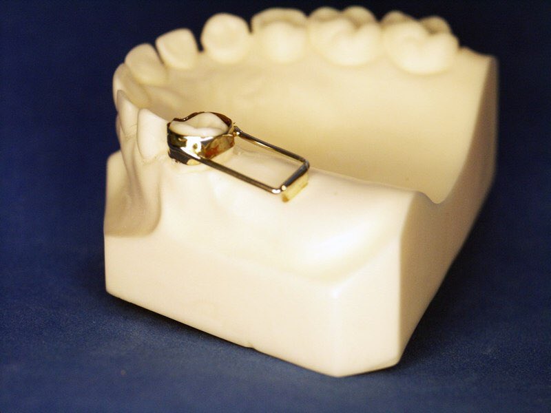 Pediatric Dentistry 💙 on Twitter: