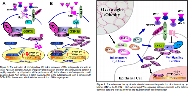 Inflammation Driven Activation of Wnt Pathway: A Potential Mechanism Responsible for Obesity-associated Colorectal Cancer
Article Link: bit.ly/3dmRWTK
#Obesity #Inflammation #WntPathway #ColorectalCancer