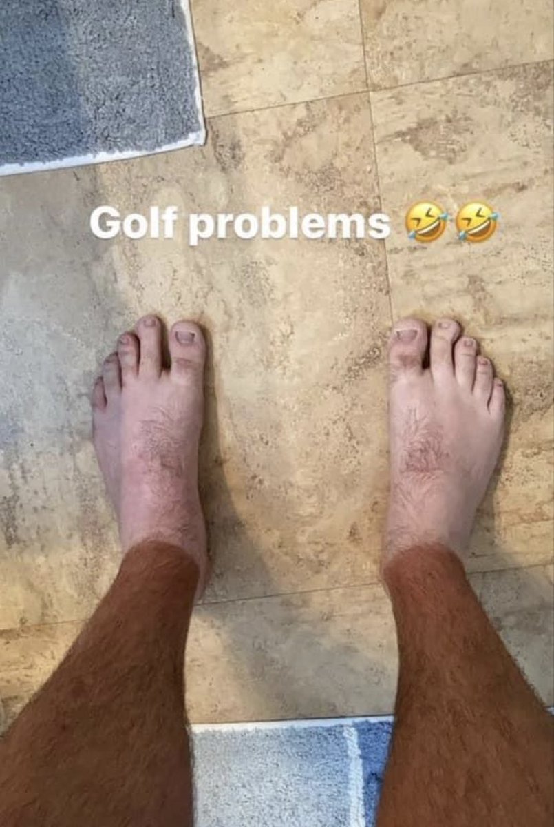 Seen in public with flip flops