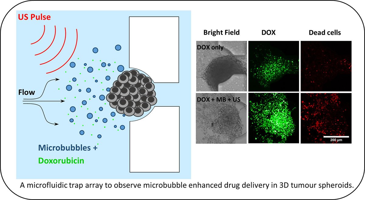 MattBourn3's tweet photo. Very happy to announce that the final version of our paper is now available online! https://t.co/lHFgmT9sfq - Observing microbubble enhanced drug delivery in microfluidic spheroid cultures. Great work from everyone involved @MNP_Leeds @SalPeyman @DVBBatchelor @sdevans_leeds https://t.co/OFUA6vhqGu