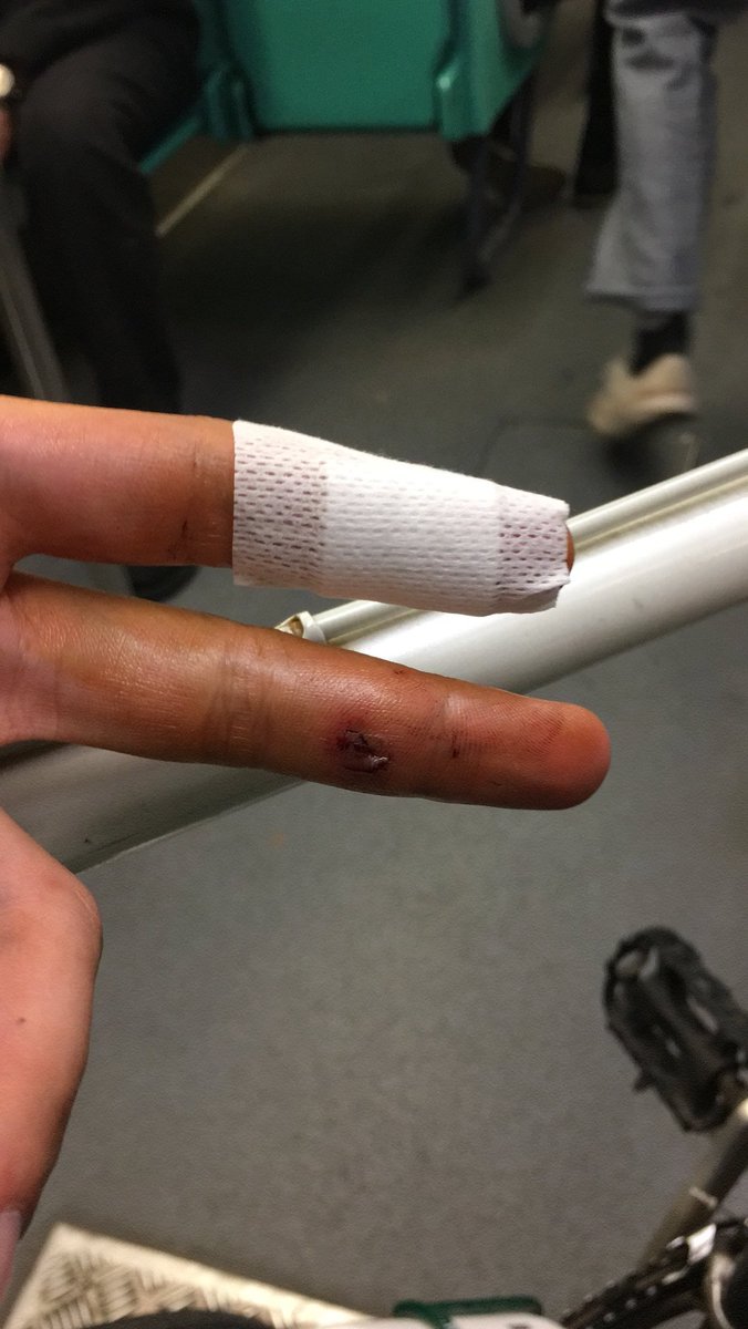 pourqwhy's tweet photo. 2 years since my first major bike accident in this exact spot. Still wondering how I got out with only stitches on my finger (and a wrecked bike ofc (really miss that bike)) https://t.co/mDXzRc25wV