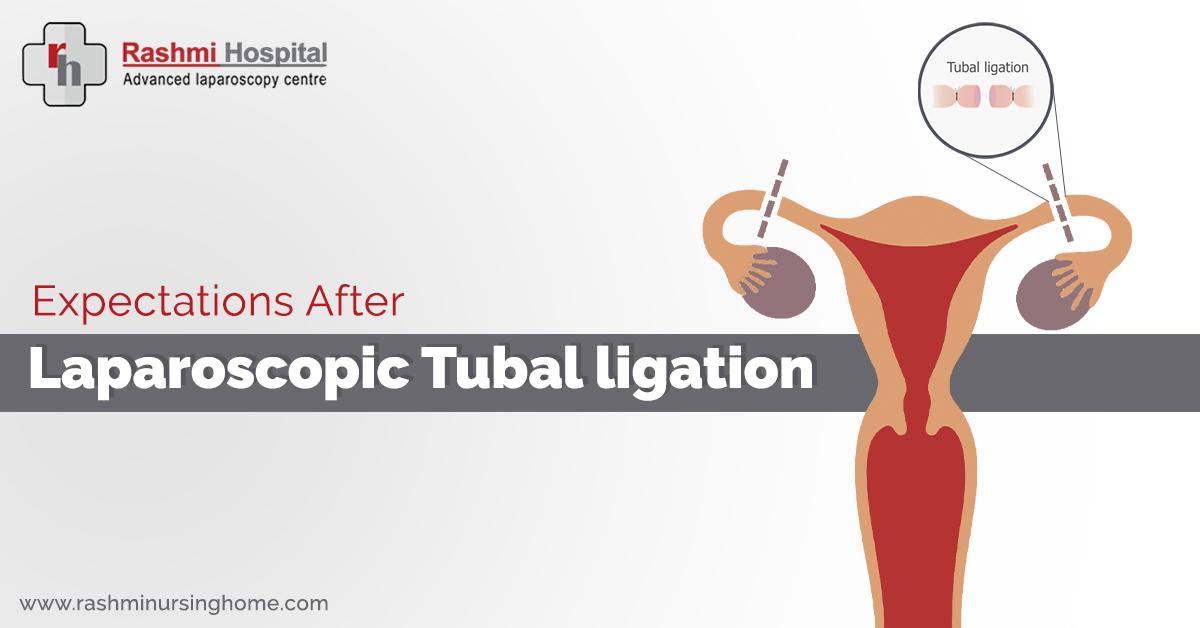 RashmiHospital's tweet photo. Tubal Ligation is a permanent birth control method. However, if you later wish to have a baby, Tubal Ligation Reversal surgery may not always be successful.

#TUBAL_LIGATION #Rashmi_Hospital #Bangalore #Pregnancy #Birth_Control

Book appointment:  https://t.co/09en8pzyop https://t.co/UxoT7QQRYV