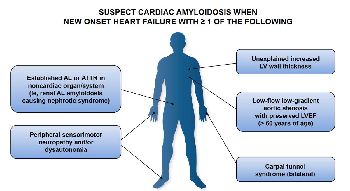 jpcostabel's tweet photo. Consideraciones prácticas en el manejo de la amiloidosis cardíaca. Gran trabajo de @DrDiegoDelgado y cols👏👏
➡️Enfermedad multiorgánica: no solo cardíaca
➡️Necesidad de manejo multidisciplinario
➡️Importancia de diagnóstico precoz y tratamiento precoz
https://t.co/AU8hkgSQBE https://t.co/sA6KTkOek8