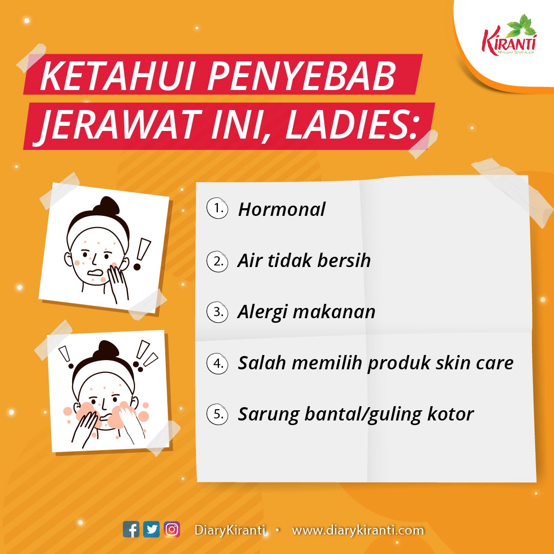 DiaryKiranti's tweet photo. Jerawat pasti menjadi masalah kulit wajah yang paling menyebalkan untuk Ladies. Bahkan hampir setiap bulan Ladies harus berurusan dengan masalah ini setiap akan datang bulan. Ketahui penyebab lainnya juga dan cara menanganinya yuk, Ladies!
#Kiranti #jerawat #tipskulit https://t.co/Pa6gbmkvWp