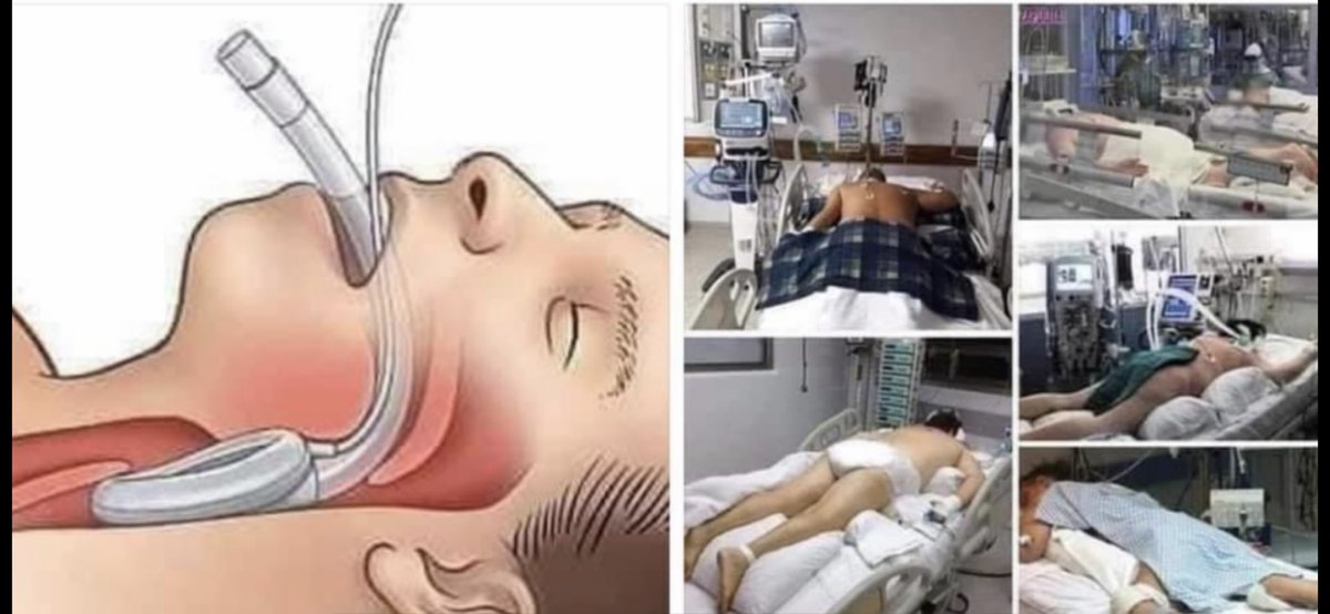 "La mascarilla me molesta y me da calor".