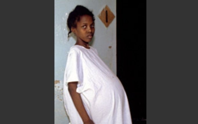 MAbolicion's tweet photo. Cada año aproximadamente 14 millones de niñas y adolescentes se convierten en madres (violaciones, matrimonios infantiles, falta de acceso a medidas de control de natalidad). 
#PorNacerNiñas https://t.co/0fDMB6lJef