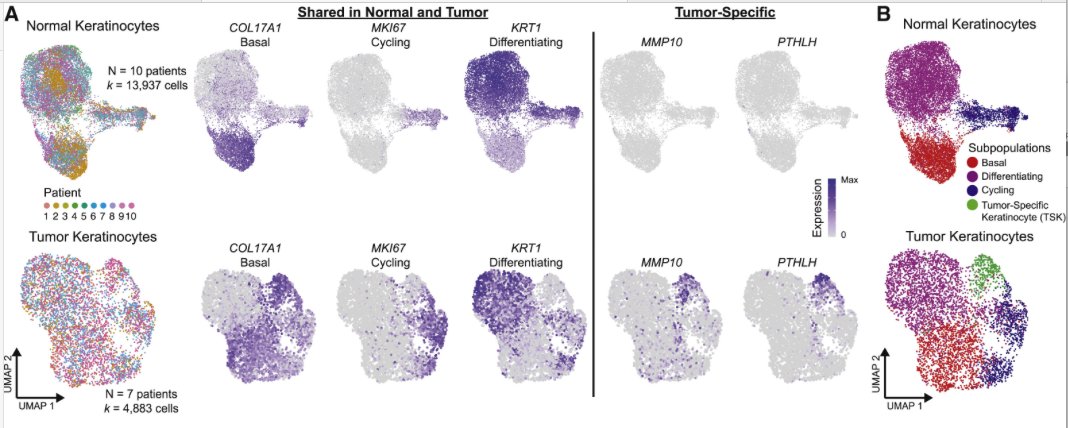 mmw_lmw's tweet photo. Multimodal Analysis of #CellularComposition and #SpatialArchitecture | Normal Skin and Human #SquamousCell_Carcinoma | Paul Khavari @StanfordMed @CellCellPress https://t.co/Z9xlf1vaPG https://t.co/BH4t8BRuV8