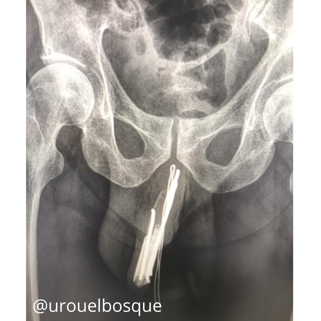 Urología Universidad El Bosque tweet media
