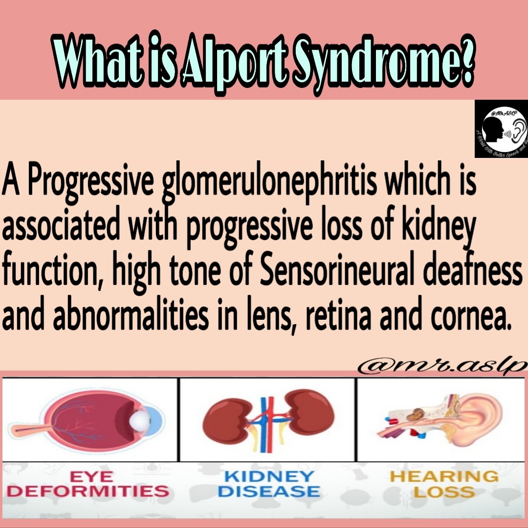 AslpMr's tweet photo. Alport syndrome is a genetic condition characterized by kidney disease, hearing loss, and eye abnormalities.
#mraslp #alport
#alportsyndrome #syndrome
#hearing #hearingloss
#KidneyDisease  #awareness
#betterlife #speechlanguagepathologist
#audiologist https://t.co/yNFz6dniRA
