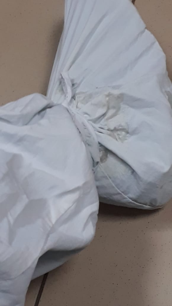 TifaniRoberts's tweet photo. #Covid19Nicaragua
Médicos en Sermesa no tienen protección, solo pijamas de tela que tienen que amarrar con tiras porque están rotas. ¿Los dueños del ejército con todo su dinero no podrá darle equipos adecuados? @EjercitoNic @opsoms https://t.co/GqJyhLWFqo