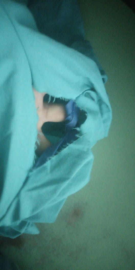 TifaniRoberts's tweet photo. #Covid19Nicaragua
Médicos en Sermesa no tienen protección, solo pijamas de tela que tienen que amarrar con tiras porque están rotas. ¿Los dueños del ejército con todo su dinero no podrá darle equipos adecuados? @EjercitoNic @opsoms https://t.co/GqJyhLWFqo