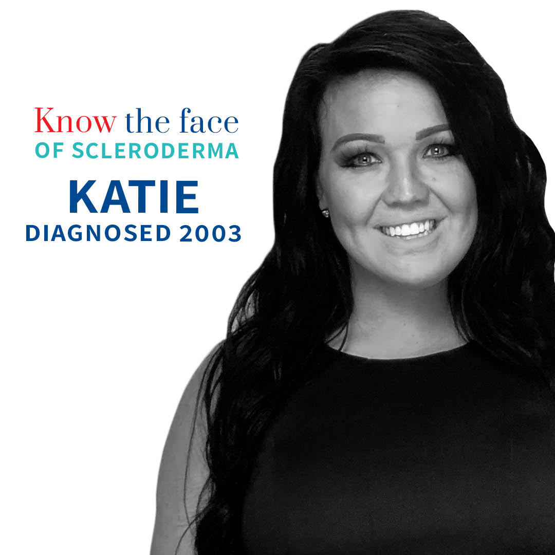 SclerodermaCAN's tweet image. Say "hi" to Katie Kinson, a #scleroderma patient and a @syttd star. 👰 #SclerodermaAware bit.ly/2LspCUj