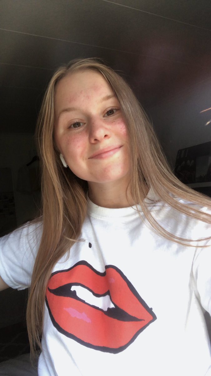 klara 💌 | 🇸🇪 (@alexbeijer) on Twitter photo I finally got my Lip shirt that I bought as a late graduation present for myself 🤩🥰 <a href="/GillianA/">Gillian Anderson</a> #GAlips
If you want one you have until friday to buy one at <a href="/redbubble/">Redbubble</a> and all the proceeds goes to <a href="/SAYesMentoring/">SAYes Mentoring</a> !! 🙏🏻💋 I finally got my Lip shirt that I bought as a late graduation present for myself 🤩🥰 <a href="/GillianA/">Gillian Anderson</a> #GAlips
If you want one you have until friday to buy one at <a href="/redbubble/">Redbubble</a> and all the proceeds goes to <a href="/SAYesMentoring/">SAYes Mentoring</a> !! 🙏🏻💋