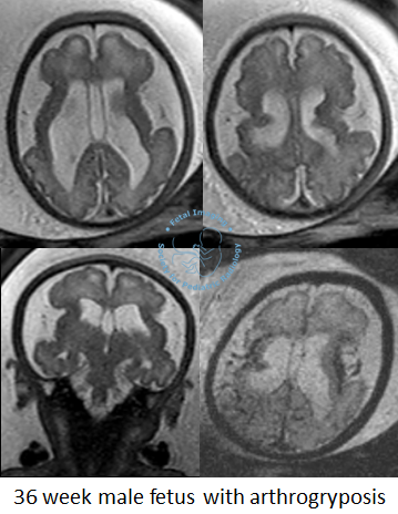 Fetal Imaging tweet media