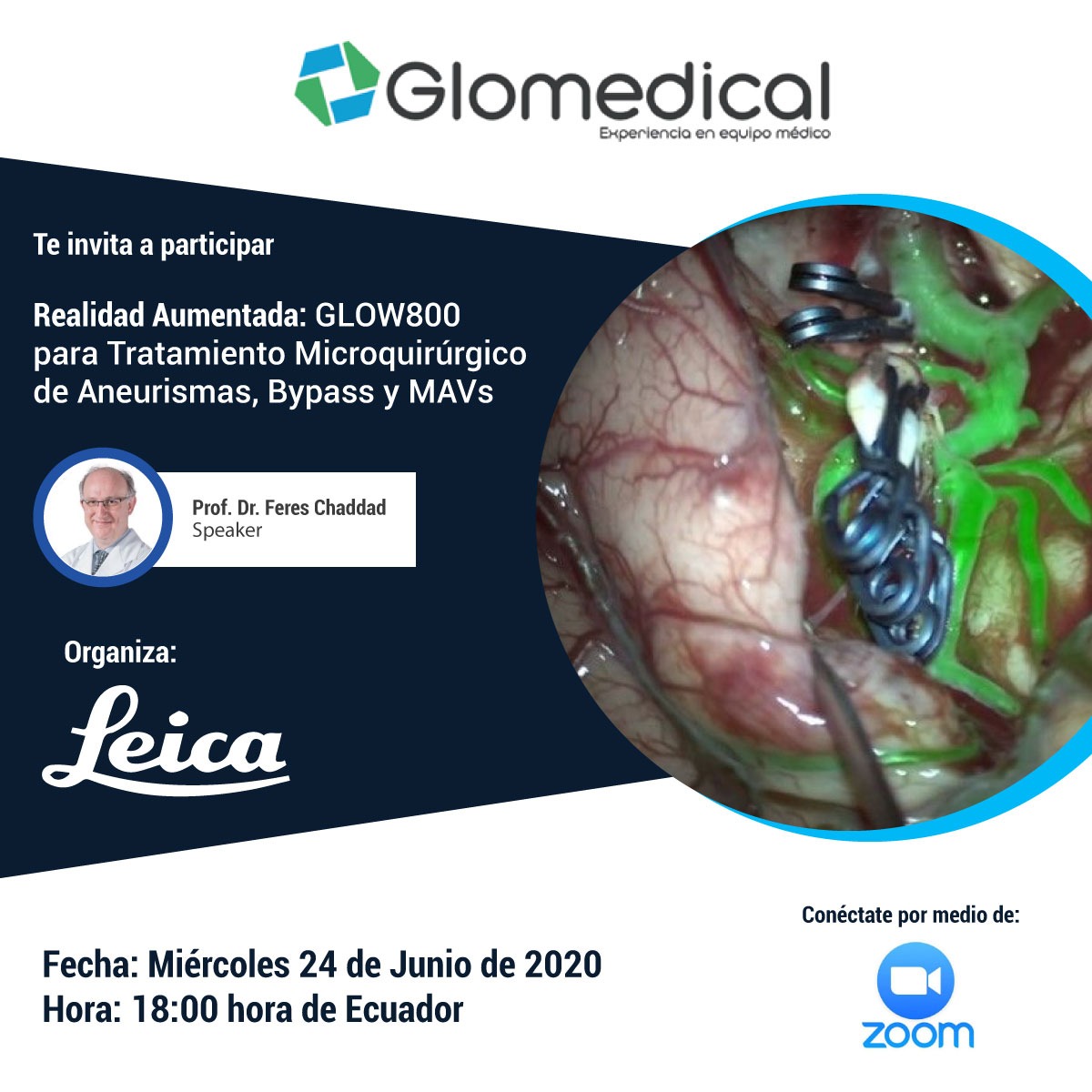 GLOMEDICAL's tweet photo. Glomedical te invita a participar En el Webinar Realidad Aumentada: GLOW800 para Tratamiento Microquirúrgico de Aneurismas, Bypass y MAVs https://t.co/ISz0jWZhui
