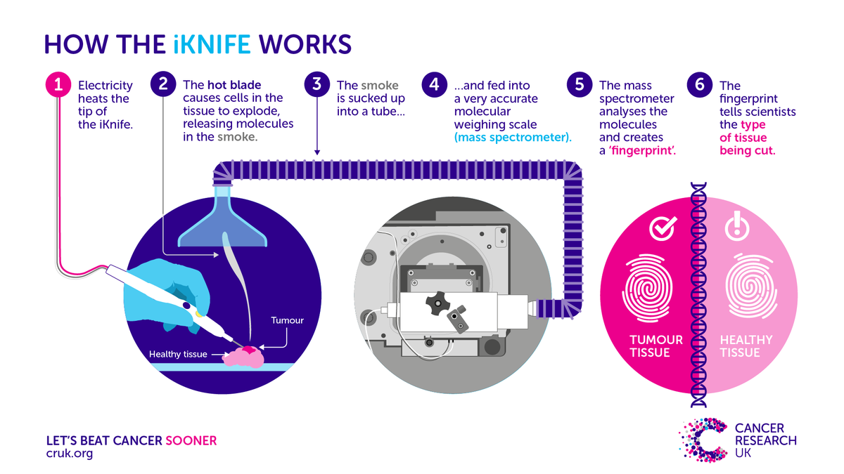 CR_UK's tweet photo. The iKnife is a device used to sniff out cancer during surgery. In our latest blog post, we found out how the iKnife has been used to uncover even more detailed information about tumours 🔍 https://t.co/K9nyJmKbnu #CancerGrandChallenges https://t.co/8DUFJAwBVr
