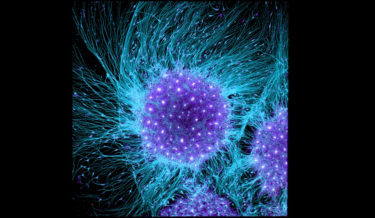 BrivanlouLab's tweet photo. Ali says "My synthetic brains are having a bad hair day."
#SyntheticBrain #Brain #BadHairDay #Hair #AliBrivanlou #BrivanlouLab #PrimordialBrainCells #Cerebroids #HumanBrain #StemCells #RUES2 #STEM #RockefellerUniversity #SyntheticEmbryology #LaboratoryOfSyntheticEmbryology https://t.co/MFQ6uVALwC