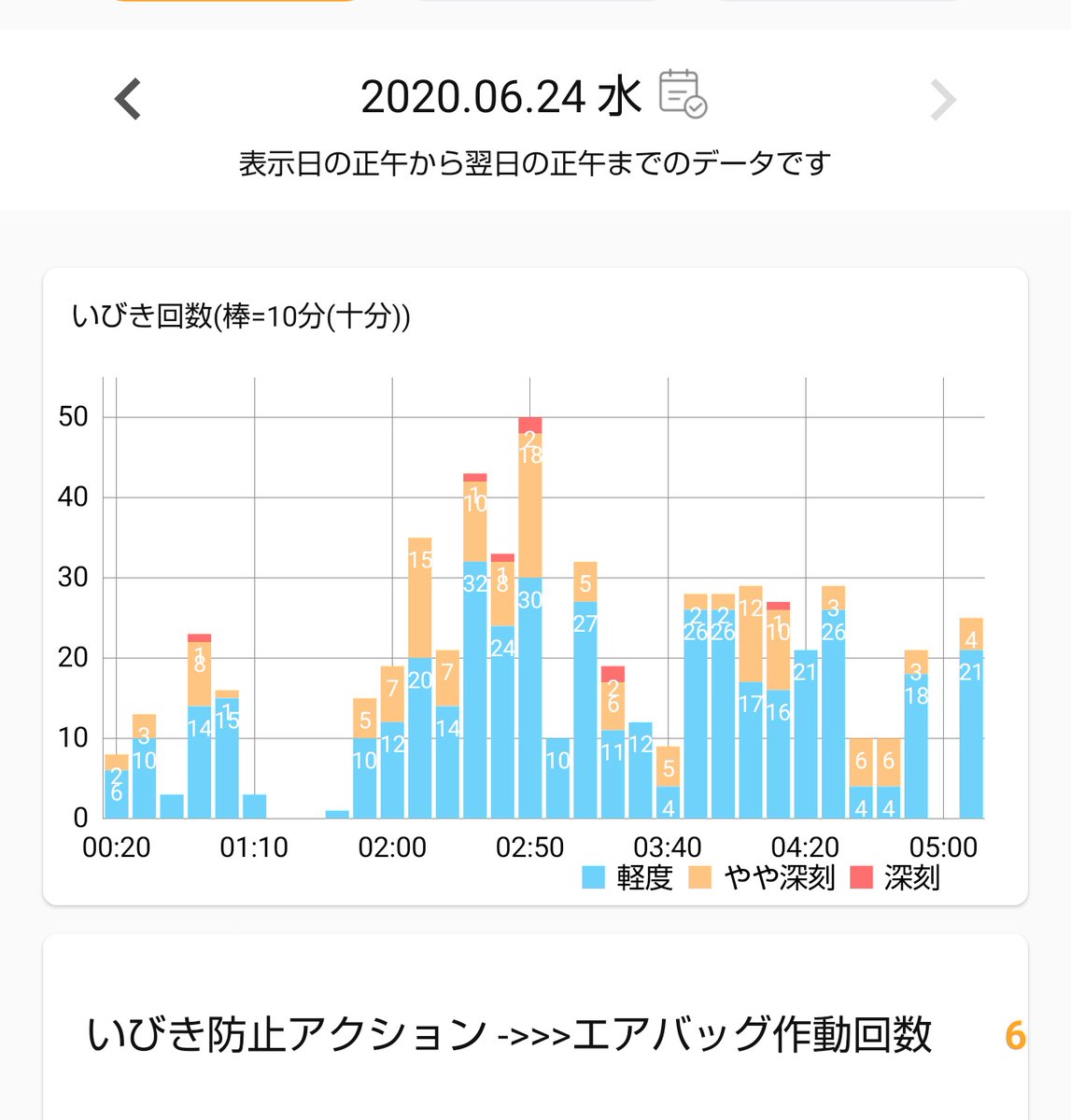 トルネル いびき