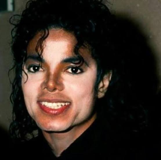 1n 1986 Micheal Jackson noticed white patches on his hand that was why he wore his famous glove...not as a fashion statement but to cover the patches...Patches started appearing on his face...So what CAUSED it...What Are The CAUSES Of VITILIGO?- The exact causes of...
