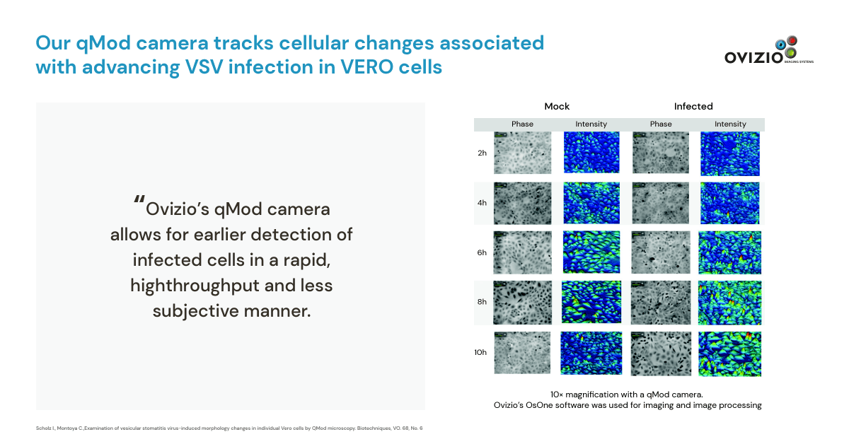 ovizio's tweet photo. Congrats to @ologybio for this paper using #Ovizio's qMod digital holographic camera and OsOne machine-learning software! Read their paper in full here: https://t.co/2c0fFEOXxY. Visit https://t.co/gTyOmuFSpZ, or follow us on LinkedIn or Twitter @ovizio  #celltherapy #genetherapy https://t.co/Fp6qOssb1G