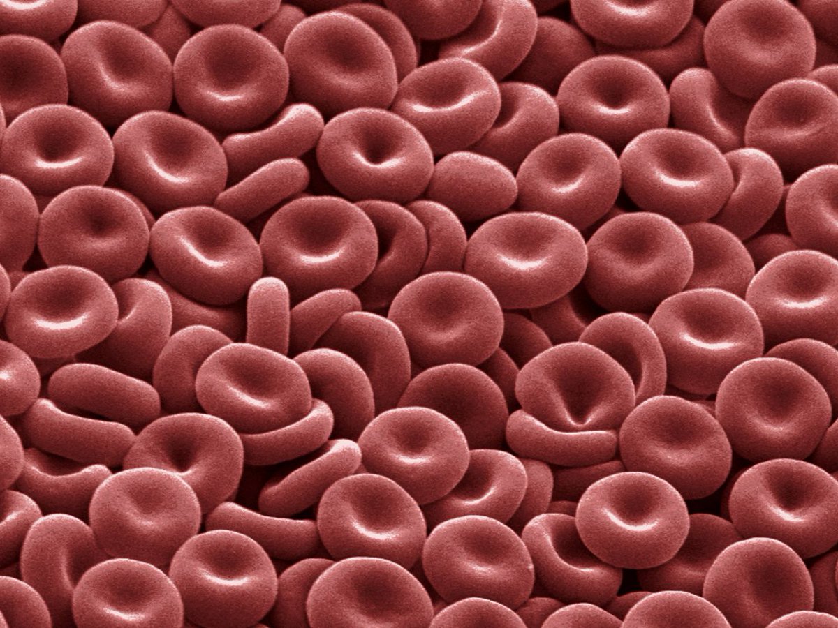 Why is blood red? This color has such a rich symbolism in human history - in art, literature, religion (e.g., Catholic Cardinals wear red robes to symbolize the blood of Christ).  #HematologyTweetstory28 considers the color of human blood...and how it might have been different./1