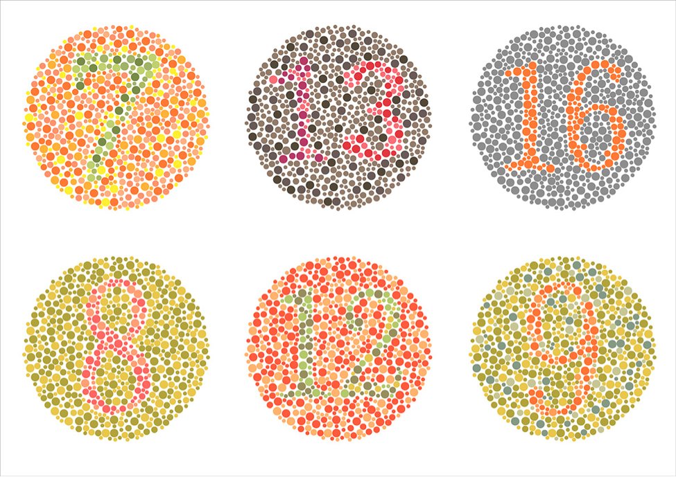 8% of men have "color vision deficiency" & can’t see part of the spectrum - e.g., one of my heroes, the late Gordon Dewald (1933-2010),  @MayoClinic Cytogenetics Head. When Gordie started in the 1960s, karyotyping was B&W. It was a challenge for him to adjust to red-green FISH!/3