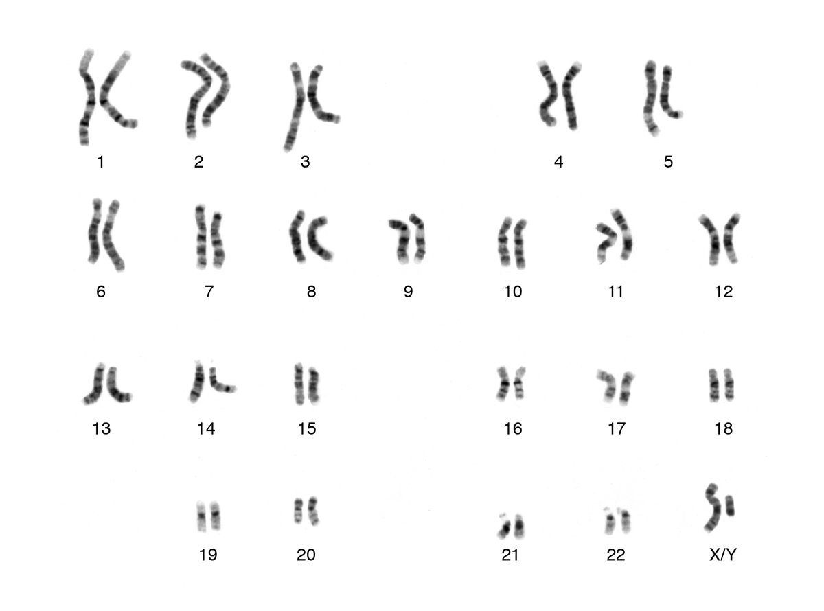 8% of men have "color vision deficiency" & can’t see part of the spectrum - e.g., one of my heroes, the late Gordon Dewald (1933-2010),  @MayoClinic Cytogenetics Head. When Gordie started in the 1960s, karyotyping was B&W. It was a challenge for him to adjust to red-green FISH!/3