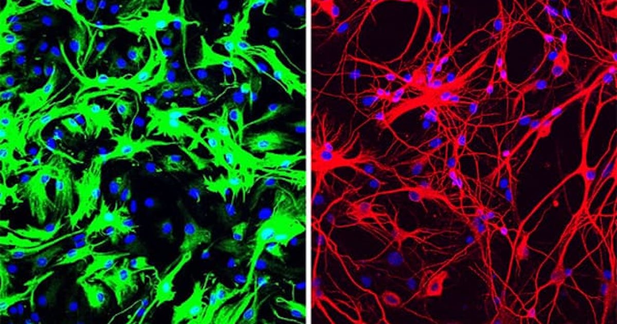Single-gene treatment cures mice of Parkinson's within three months ecs.page.link/J2GTP  #ENDALZ