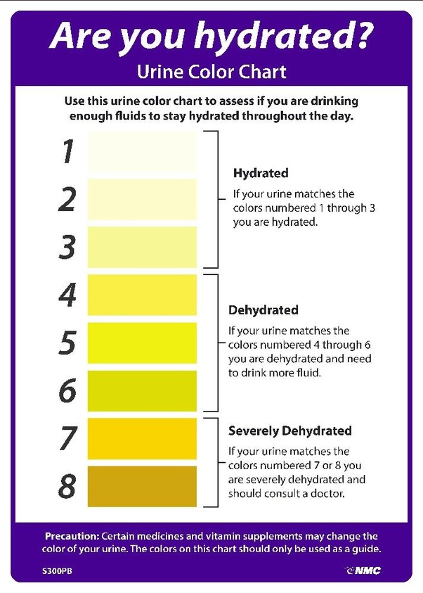 One footnote: a related misconception is that urine is yellow because of bilirubin. I think this idea arises because people with bile duct obstruction become jaundiced and yellow & urine does change color in hyperbilirubinemia. Bilirubin is excreted as bile... /21