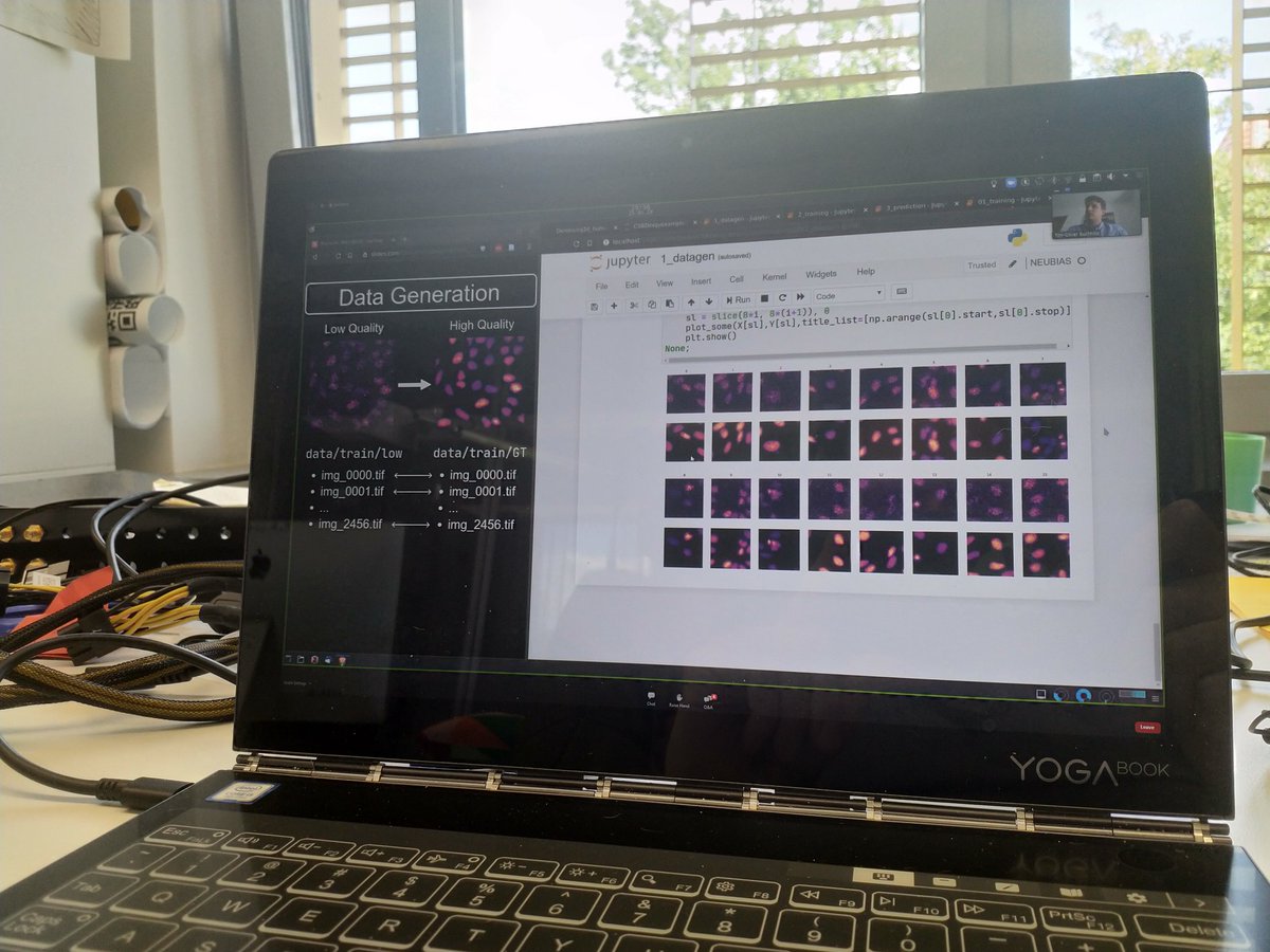 haesleinhuepf's tweet photo. The @jug_lab really spent a lot of effort into making #DeepLearning for #BioImageAnalysis accessible to end-users 🤩 Kudos to @frauzufall @tibuch_ @Mangal_Prakash_ @sagzehn @florianjug et al. Awesome #CSBDeep #NeubiasAcademy 💪👍
https://t.co/uExNt3k09h https://t.co/1REsb0yozh