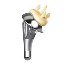 Grant_Garrigues's tweet photo. Just published in @JSESMedia great study with @FLshoulderdoc @AnthonyRomeoMD Cancienne MD and @nicholson_md Proud to be a part of it. Bottom line: Reverse TSA works as a salvage for failed anatomic, but not as good as primary. @MOR_Docs https://t.co/yVHSbm8c7D https://t.co/jCx49a7bAC