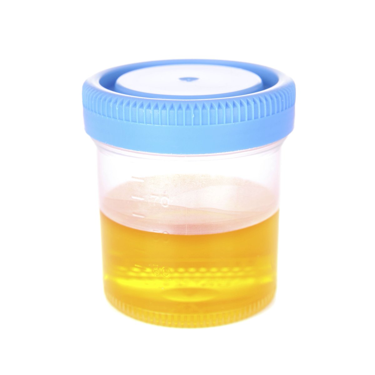 One footnote: a related misconception is that urine is yellow because of bilirubin. I think this idea arises because people with bile duct obstruction become jaundiced and yellow & urine does change color in hyperbilirubinemia. Bilirubin is excreted as bile... /21