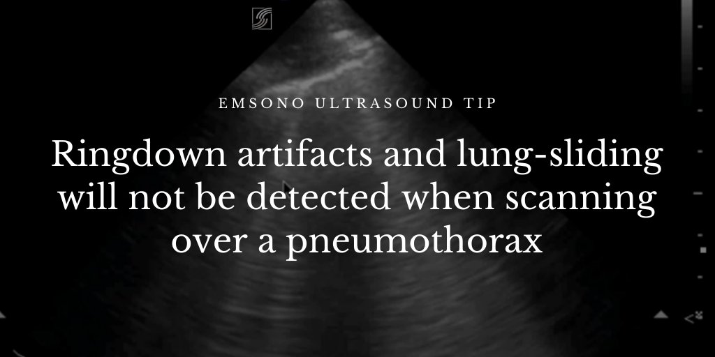 EMsonoPOCUS's tweet photo. EMsono Ultrasound Tip - Ringdown artifacts and lung-sliding will not be detected when scanning over a pneumothorax. #EMsono #POCUS #ringdown #PTX #lung https://t.co/U3hBJUmYNr https://t.co/AsyjbGddv2
