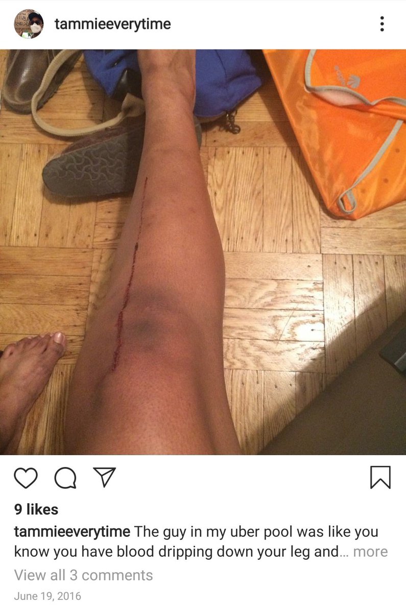 Speaking of 'why would anyone post this stuff to instagram', ***graphic content warning*** for anyone not good with blood