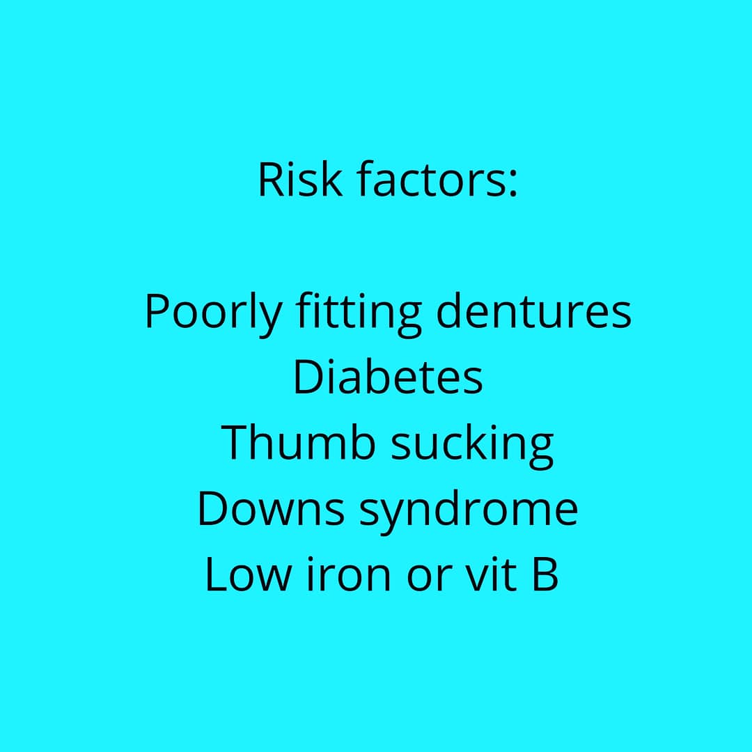 wildeemma5's tweet photo. The elderly often suffer with this condition. Conditions like this should always be recorded on oral health assesment forms if someone is in a care setting.

For FREE oral health assesment forms to download or duplicate email info@kohc.co.uk

Please feel free to share

#RETWEEET https://t.co/EqZZqnRsev