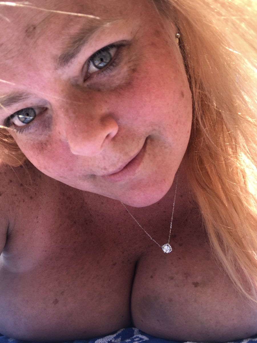 FairGirl22's tweet photo. Had a great day at the quarry! Such a beautiful day! #summerfun #swimming #suntanning #sunburn #freckled https://t.co/uPg2NJPfgl